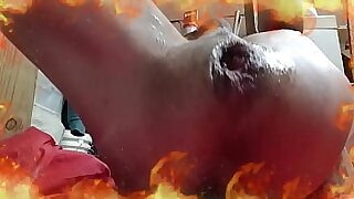 UNA INSERCION EXTREMA DEL GLOTON